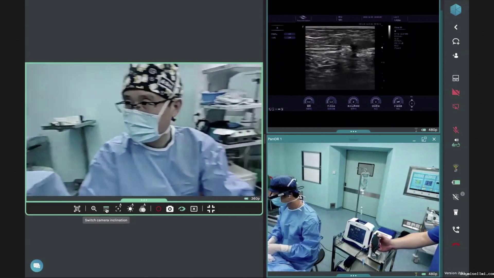 静脉曲张微创射频手术直播-蒋劲松图片