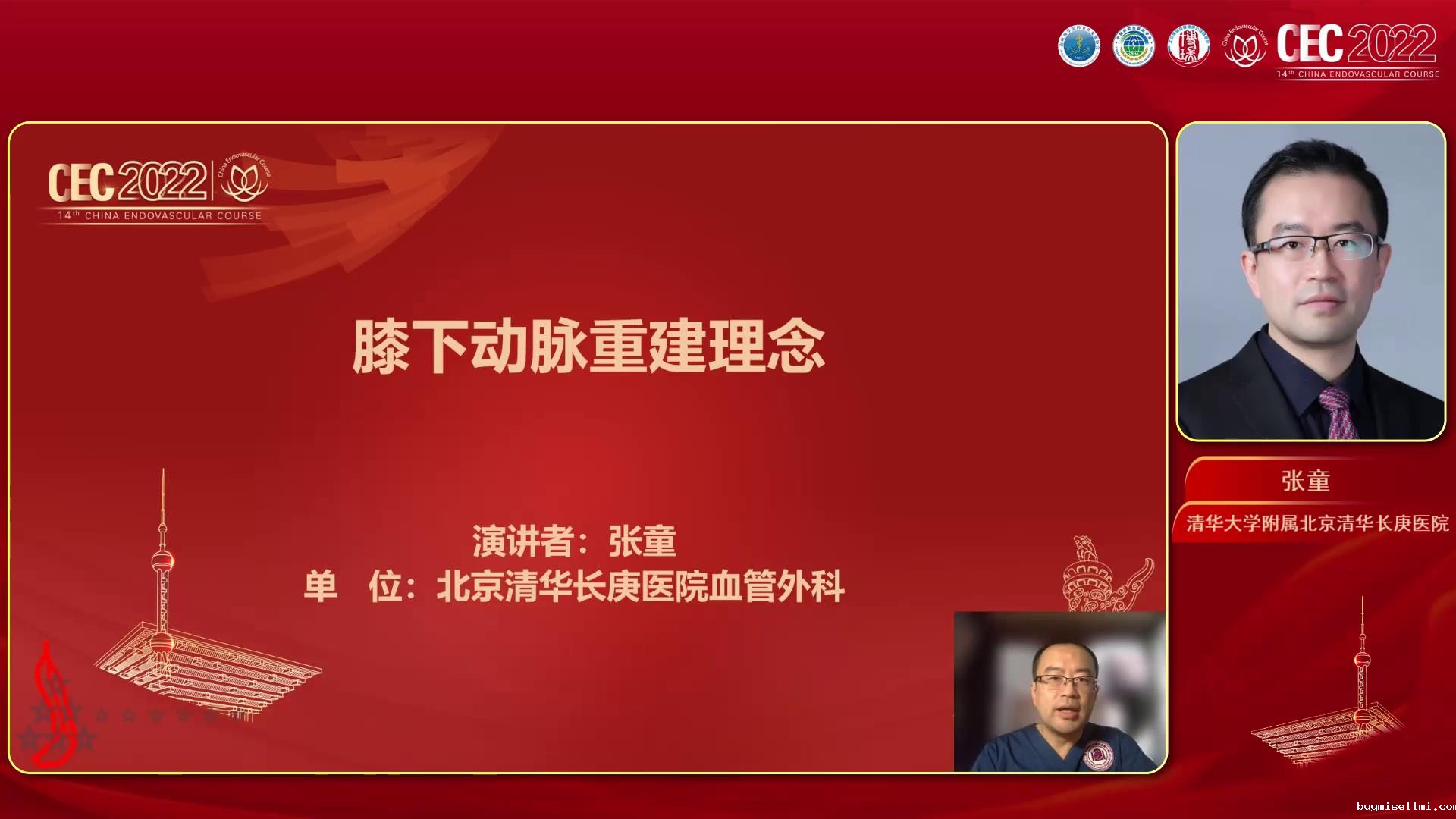 膝下动脉重建理念-张童图片