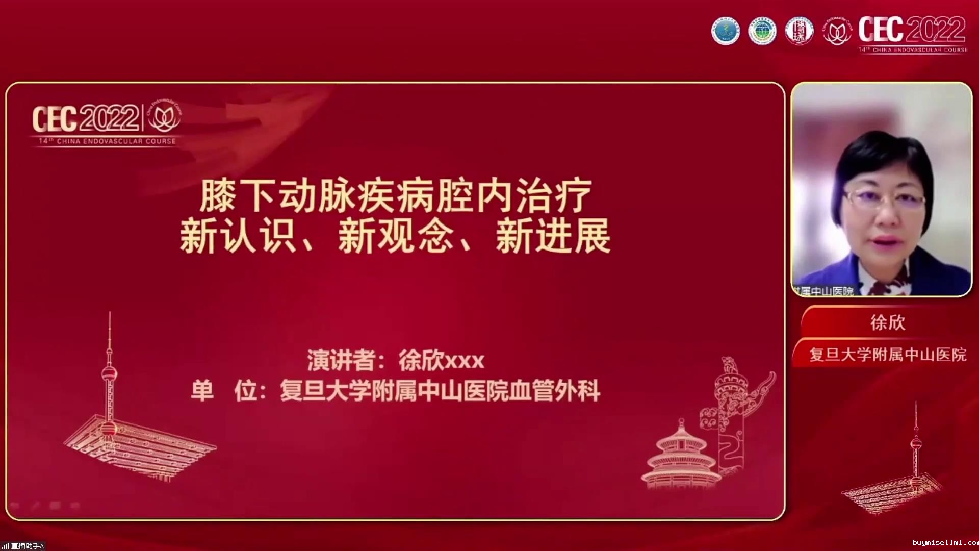 膝下动脉疾病腔内治疗新认识、新观念、新进展-徐欣图片